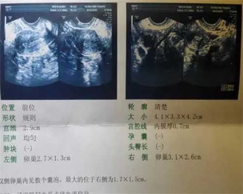 2023
代孕合法_50岁借卵代生,北京供卵试管医院排行榜
