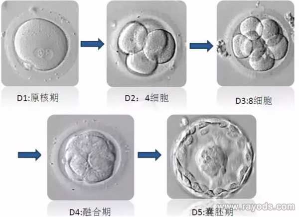 上栗代孕专家_2023
最新价格表,试管胚胎等级分类，二级胚胎是不是优质胚胎？