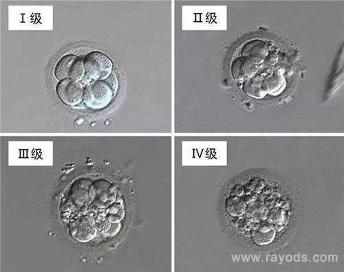 上栗代孕专家_2023
最新价格表,试管胚胎等级分类，二级胚胎是不是优质胚胎？