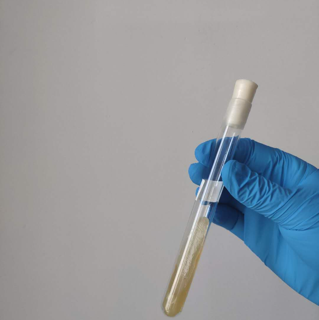 怀孕要注意哪些事项_备孕最忌讳的水果,西安高新医院助孕做一次试管婴儿需要