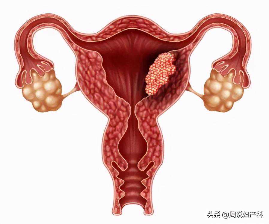 月经期子宫内膜厚度多少